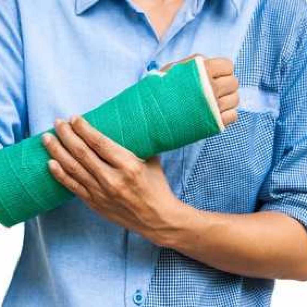 Is My Injury Serious Enough to Need a Lawyer
