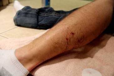 How to File a Dog Bite Claim in Genesee County, New York